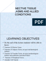 Connective Tissue Neoplasms