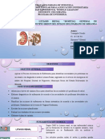 Ysangela Caso Clinico Litiasis