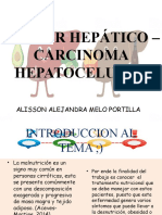 Cáncer Hepático - Carcinoma Hepatocelular
