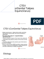 CTEV: Understanding Clubfoot (Congenital Talipes Equinovarus