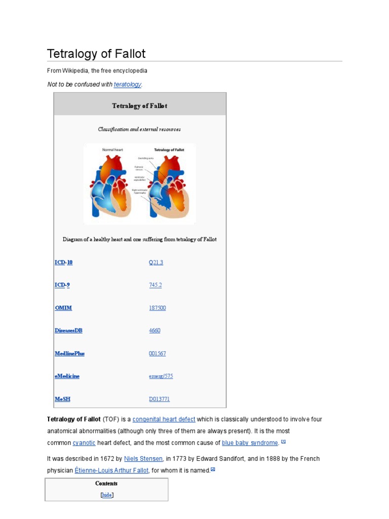 Who discovered tetralogy of fallot image