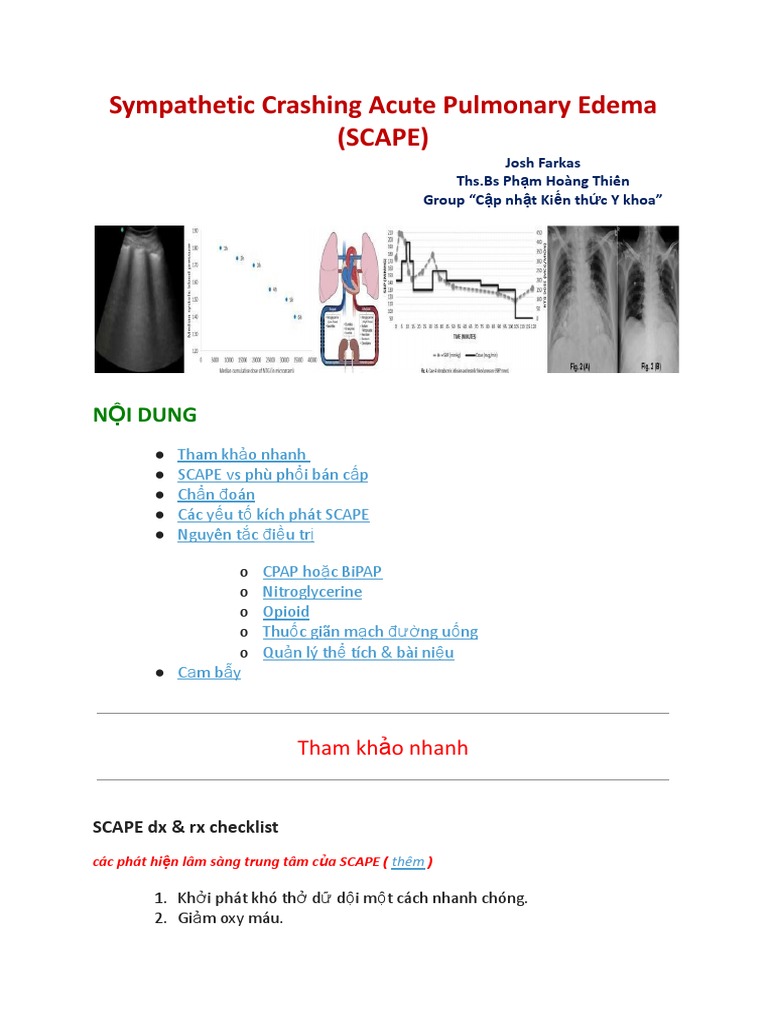 Sympathetic Crashing Acute Pulmonary Edema | PDF