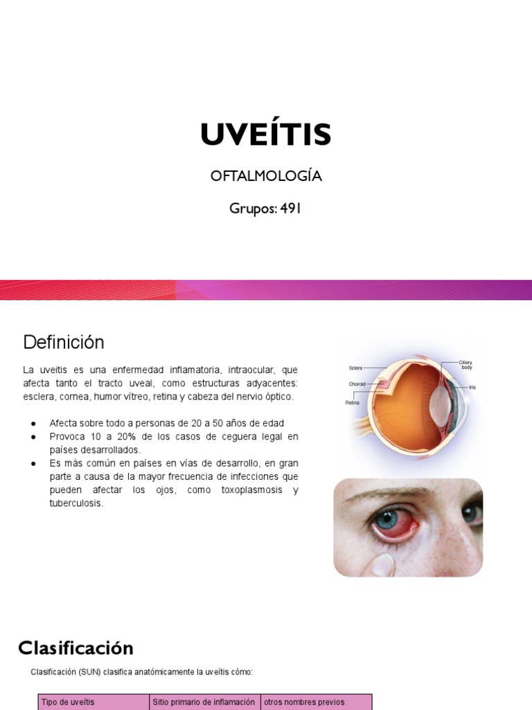 Copia de Uveitis | PDF | Herpes Simple | Ojo humano