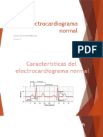 Electrocardiograma normal: características y análisis vectorial