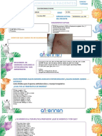 Seguimiento paciente TBC MDR con resistencia ampliada