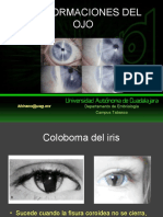 Tema 28-Malformaciones Del Ojo