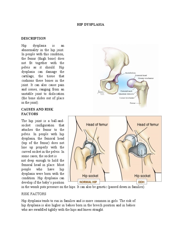 Dietary Factors That Cause Hip Dysplasia preview