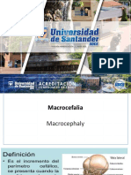 Macrocefalia