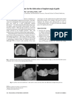 Use of Vinyl Polysiloxane For The Fabrication of Implant Surgical Guide