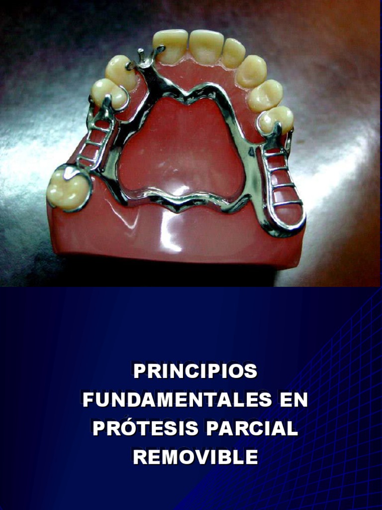 Principios Fundamentales en PPR | PDF | Dentadura postiza