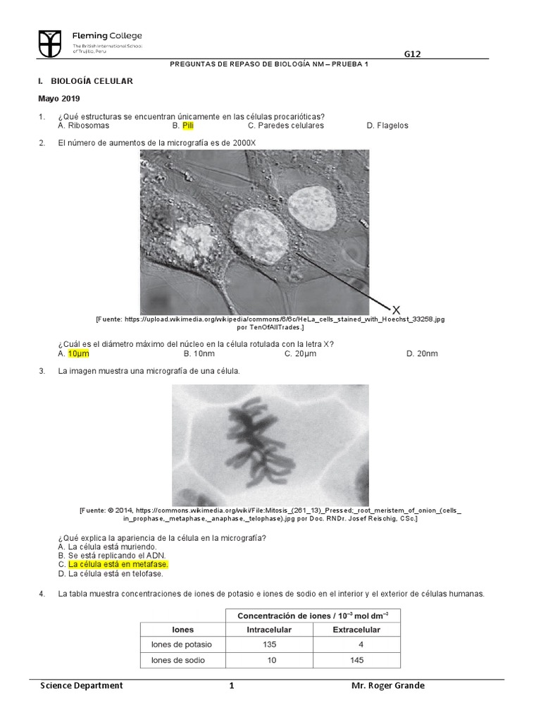 Profase 1 Rotulada Reporte Meiosis.docx Universidad San Francisco De