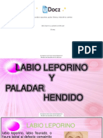 Labio Leporino y Paladar Endido PPT 359359 Downloable 1636429