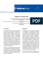 2.imágenes en Osteoartritis