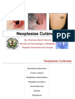Tema 05 - Neoplasias Cutáneas (Clase)