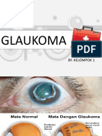 Glaukoma: By. Kelompok 1