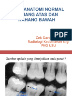 RD 5.7 Gambaran Radiografi Anatomi Normal Dan Patologis Dan Teknik Radiografi Rahang Atas Dan Rahang Bawah