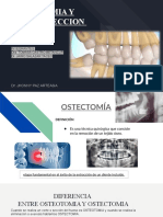 Ostectomia 1 Odontoseccion