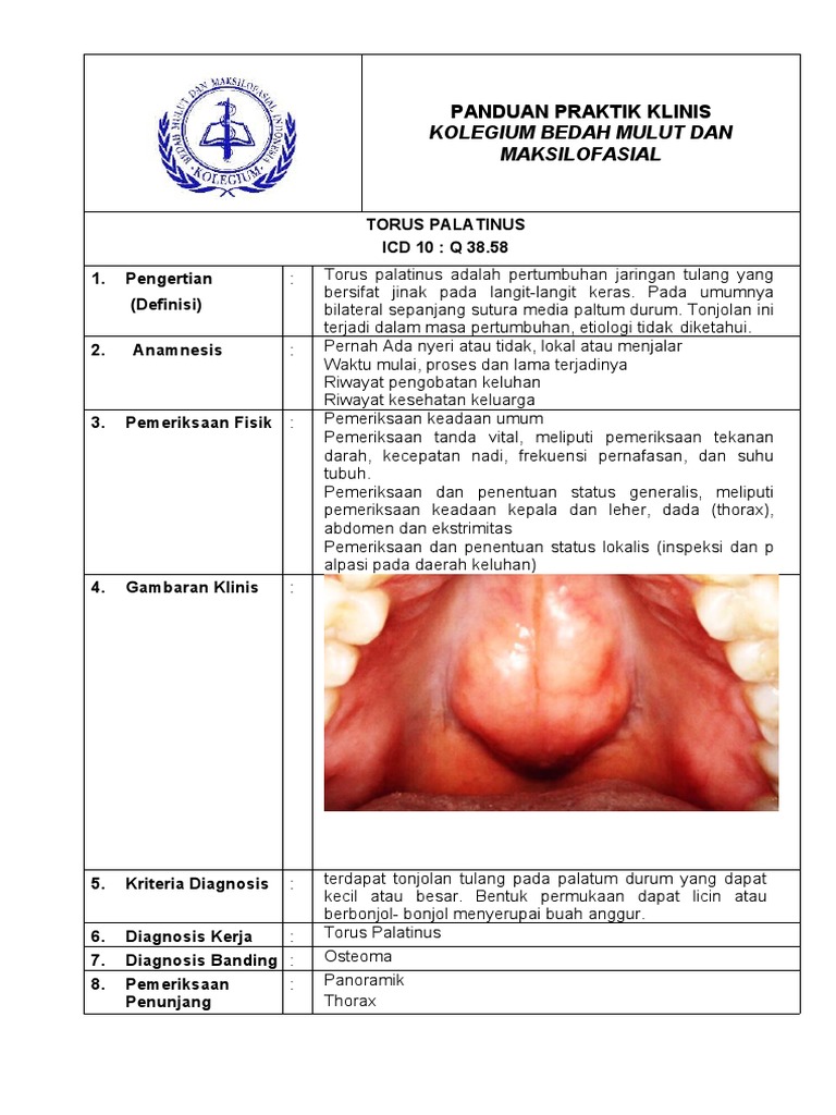 Panduan Torus Palatinus dan Tatalaksana | PDF