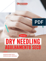 Ebook Dry Needling