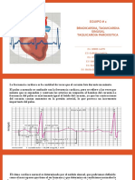Bradicardia Taquicardia Equipo #2