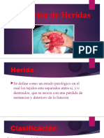 Curación de Heridas