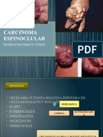 Carcinoma Espinoclular