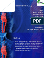 Atrial Septal Defect ASD