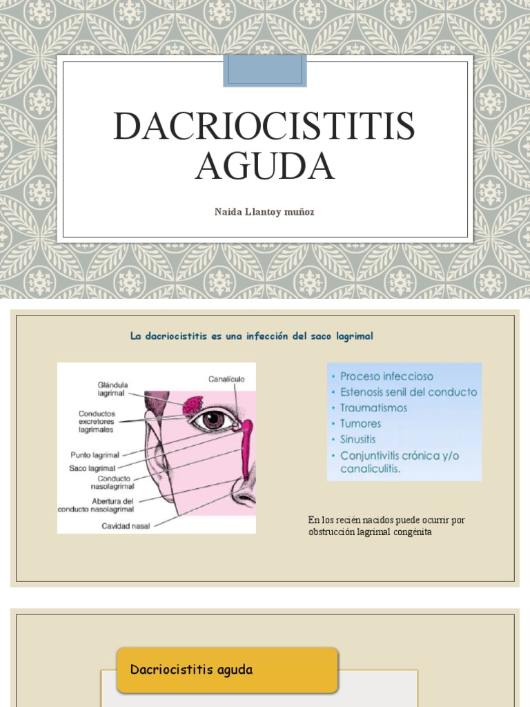 Dacriocistitis Aguda PDF