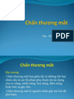 CHẤN THƯƠNG MẮT