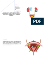 Infeccion de Vías Urinarias