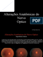 Anatomia do Nervo Óptico e Sinais de Glaucoma