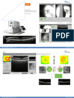 OCT Retiview 500 Optical Coherence Tomography: Feature