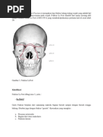 Download Fraktur Le Fort by Bayu Novianda SN60297056 doc pdf