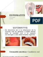 Estomatitis 2