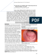 Case Report Rehabilitation of An Edentulous Mouth With Severe Mandibular Ridge Resorption Using Neutral Zone Impression Technique: A Case Report