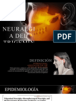 Neuralgia del trigémino: causas, síntomas y tratamiento