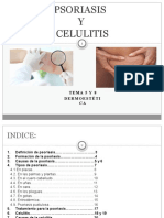 Psoriasis y Celulitis