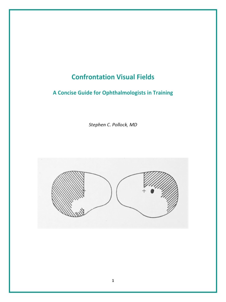 Confrontation visual fields a guide for ophthalmologists in training