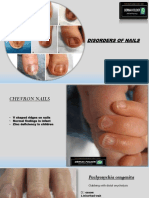 NAIL DISORDER - Derma Folder