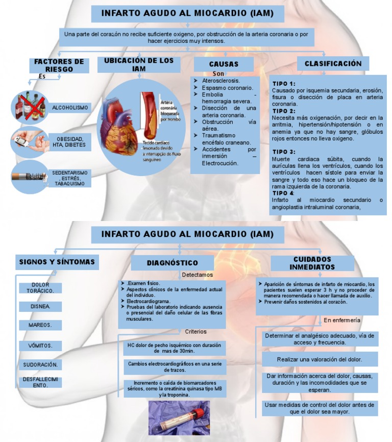 Clasificación y cuidados del IAM | PDF | Infarto de miocardio ...