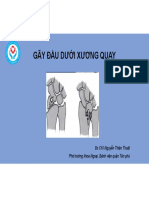 Gay Dau Duoi Xuong Quay
