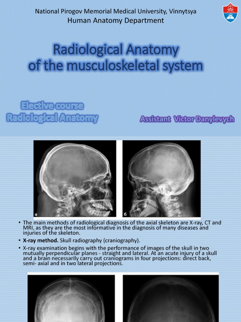 Radiol Anatomy Bones PDF