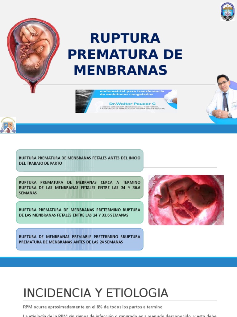 Ruptura Prematura de Menbranas | PDF | Parto prematuro | Parto