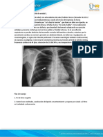 Caso de Estudio Tarea 1