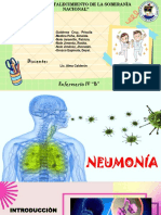 neumonia ya asma