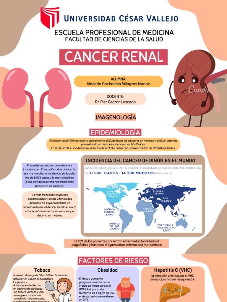 Cáncer de Riñón: Incidencia y Riesgos | PDF | Cáncer | Epidemiología