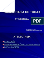 Idoc - Pub Radiografia de Torax Atelectasia