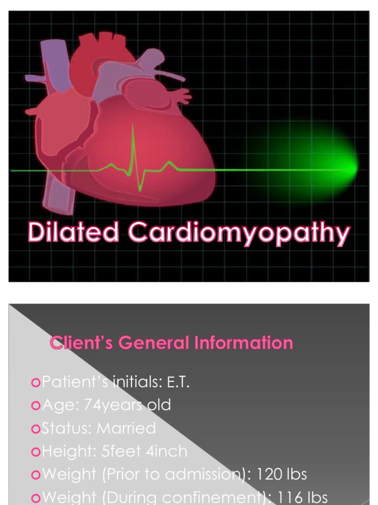 Dilated Cardiomyopathy