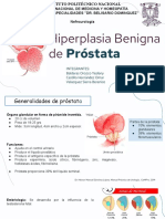 Hiperplasia Benigna De: Próstata