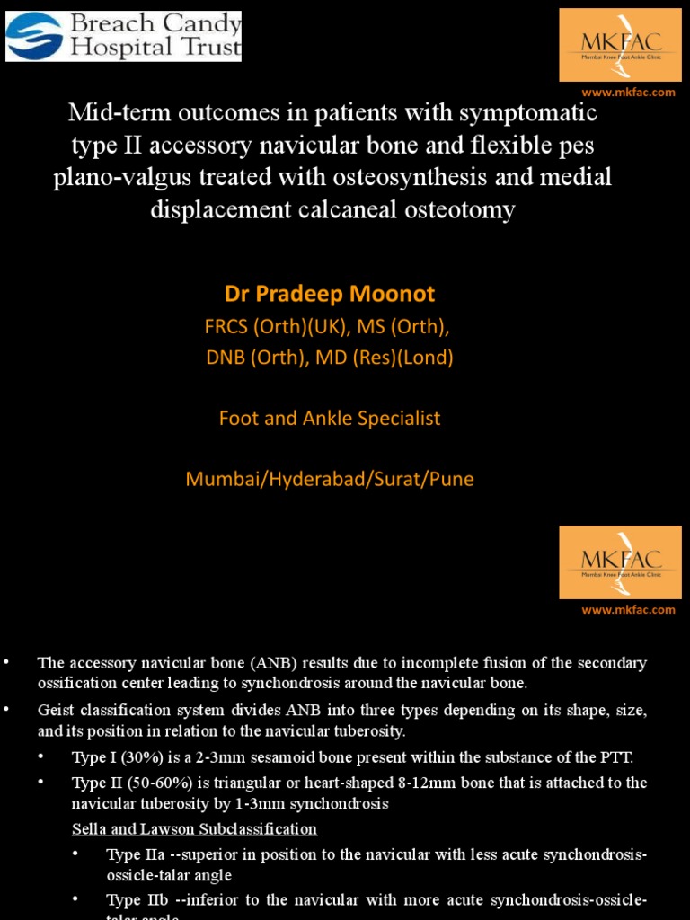 Accessory Navicular Sicot PDF Screw Musculoskeletal System